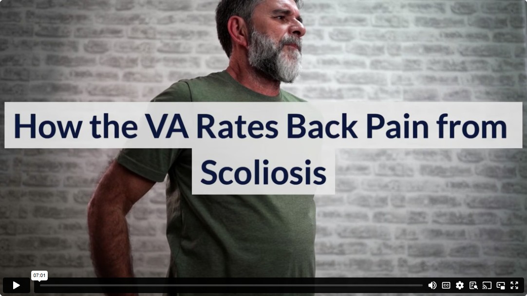 How the VA Rates Back Pain from Scoliosis